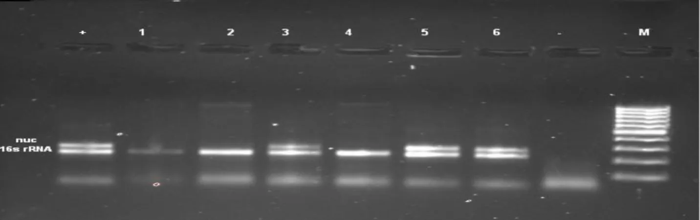 Figure 1. Confirmation of S. aureus isolates with nuc and 16S rRNA genes. M: marker; +: positive controls; - and 1: negative control;  2, 3, 4, 5, 6: 16S rRNA gene positive samples; 3, 5, 6: nuc gene positive samples