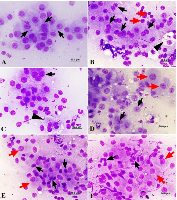 Figure  1.  A.  Aspirate  from  perianal  gland  adenoma  (case  n o  11):  Large  hepatoid  cells  showing  a  mild  pleomorphism,  granular  cytoplasm (arrows), MGG