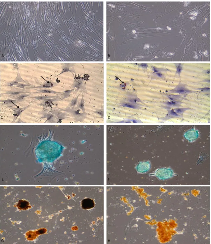 Figure 3: Fibroblast-like cells at early passage (A), oval cell morphology in relation to the number of passages (B); formation of lipid  droplets  (arrows)  during  adipogenic  differentiation  in  cells  isolated  from  young  dogs  (C)  and  old  dogs  