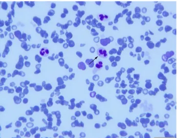 Figure  1:  An  Ehrilichia  spp.  morulae  (arrow)  in  a  neutrophil  leukocyte and anisocytic erythrocytes in blood smear