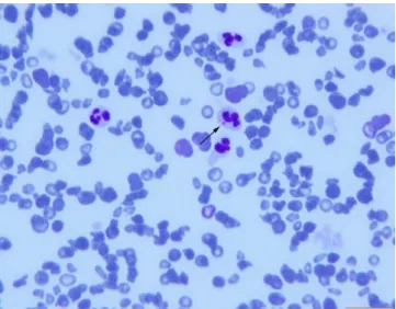 Figure  1:  An  Ehrilichia  spp.  morulae  (arrow)  in  a  neutrophil  leukocyte and anisocytic erythrocytes in blood smear