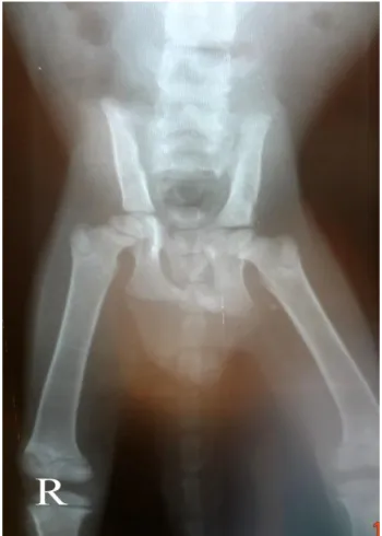 Figure  1.  Bilateral  sacroiliac  luxation  in  a  cat  (case  10).  Conservative treatment was performed