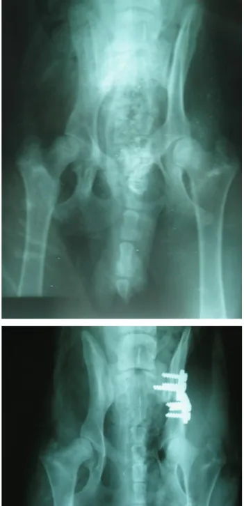 Figure  1:  (a)  Preoperative  (V\D)  radiographic  view  of  pelvis,  (b) Postoperative  (V\D)  radiographic  view  of  pelvis  after  TPO  Plate application