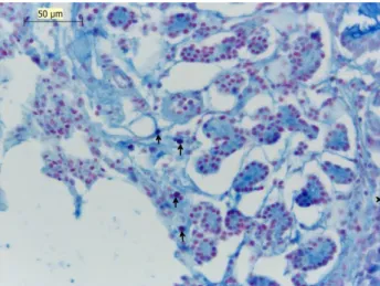 Fig.  5  Lung  intrapulmonary  bronchi  SO  (+)  mast  cell,  BLA,  Alcian Blue Safranin O