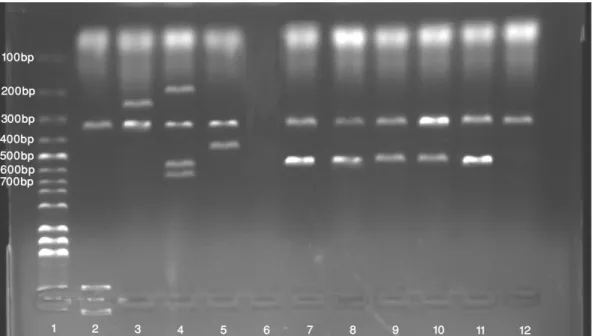 Şekil 1. Cpa geni bulunan C. perfringens izolatlarının görünümü. (1: 100 bp DNA marker, 2: Pozitif kontrol (C