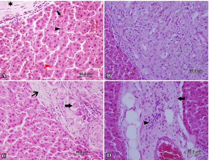 Figure 2. Group of radioiodine. A- Granuloma pattern (star), large nucleated cells (black arrowhead), small nucleated cells (red  arrowhead), dual-core pattern (arrow), HxE, x400