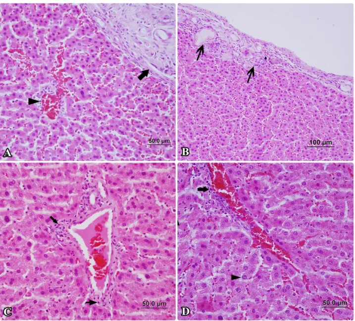 Figure 3. The pathological changes are more less prominent in the montelukast group than in the radioiodine group
