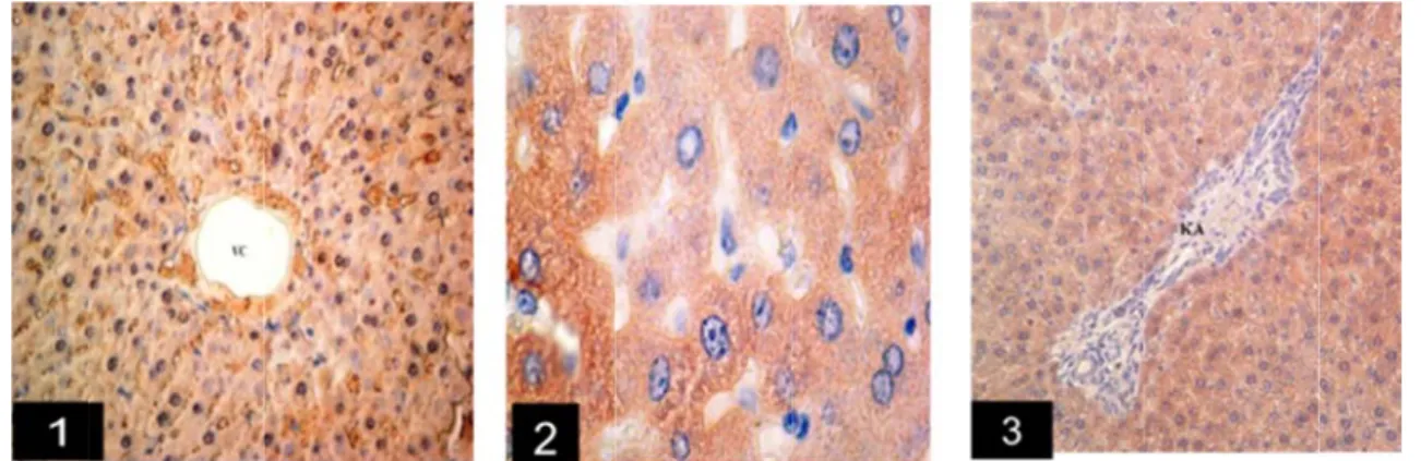 Şekil 1. CAP  vena sentralis, Şekil 3. CAP  Bar: 100µm.   Figure 1. CAP central vein. B CAP group, C Bar: 100µm