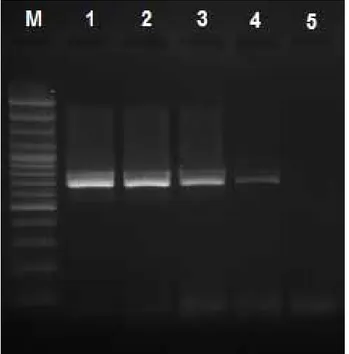 Figure 1.  The sensitivity of touchdown-PCR. 