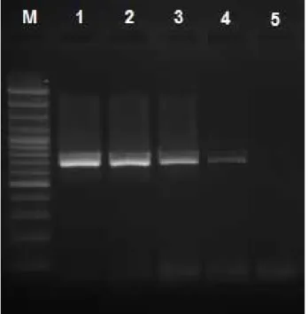 Figure 1.  The sensitivity of touchdown-PCR. 