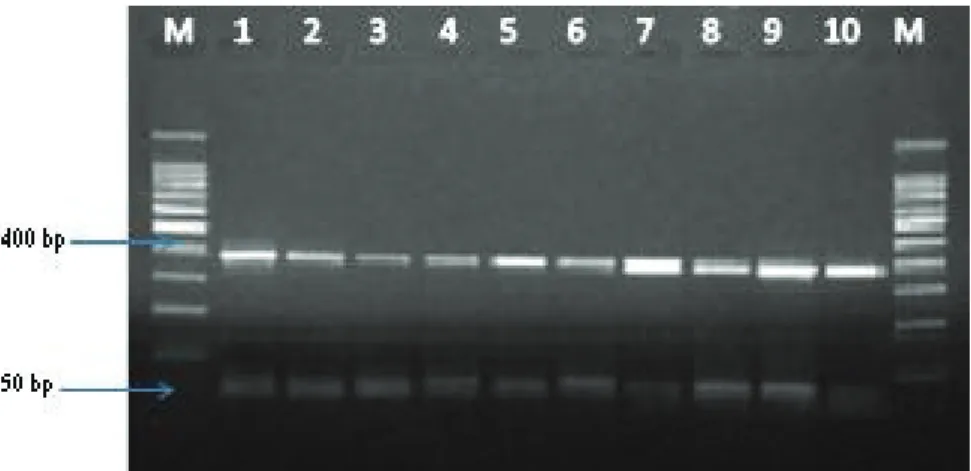 Table 4.The correlation of vancomycin resistance and virulence  genes of E. faecium (n=70) isolates in present study