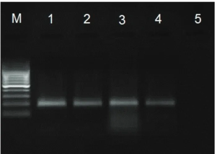 Şekil 7: P. multocida plpE geni spesifik PCR (213 bp).  