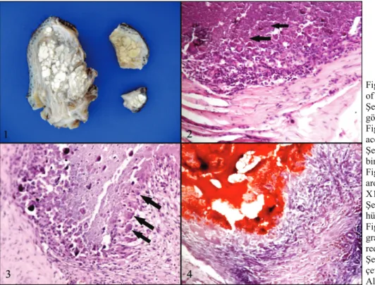 Figure 1. Macroscopical appearance  of the masses. 