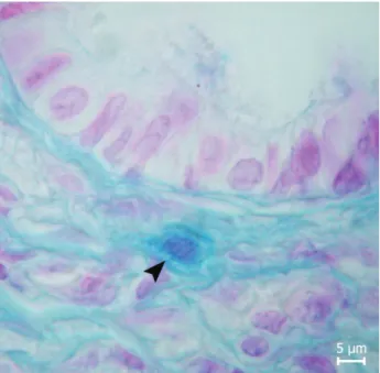 Figure 5. Mast cell (oviduct). Electron dense granules (arrow),  electron lucent granules (curved arrow) and granular electron  granules (arrowhead)