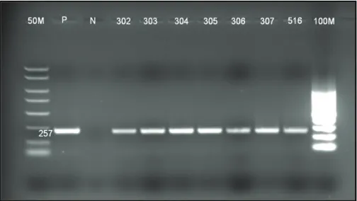 Tablo 3. PCR ile C. burnetii pozitif bulunmuş kenelerin tür ve  cins dağılımı. 