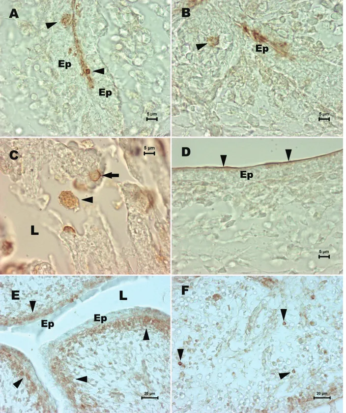 Şekil 1. Embriyonal tavuk ve bıldırcın bursa Fabricius’larında SSEA-1 ve SSEA-4 kök hücre belirteçlerinin ekspresyonu