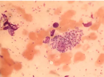 Figure 1: Leishmania sp. within reticulo-endothelial macrophage  (Original, Giemsa x1000)