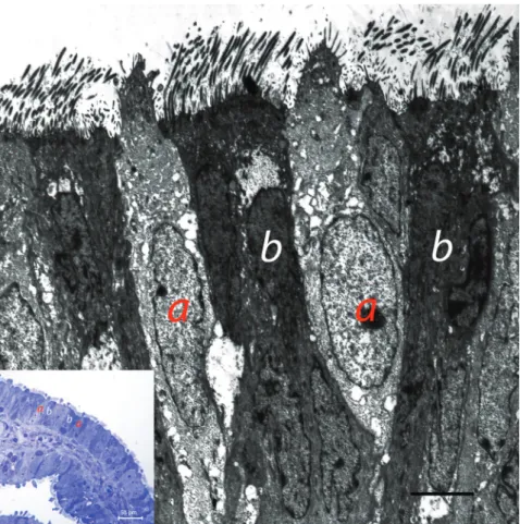 Figure 4. Electron microscopic appearance of epithelium of fimbria secretory cell (a), ciliated cells (b), secretory and ciliated cells  in semi-thine section (small photo)