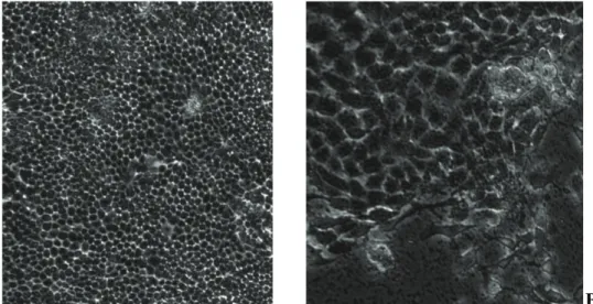 Şekil 4. Kontrol grubu MDCK hücrelerinin (A) ve 0,01 M Na 2HPO4 eklenmiş MDCK hücrelerinin (B) faz kontrast mikroskobik  görüntüleri (x40)