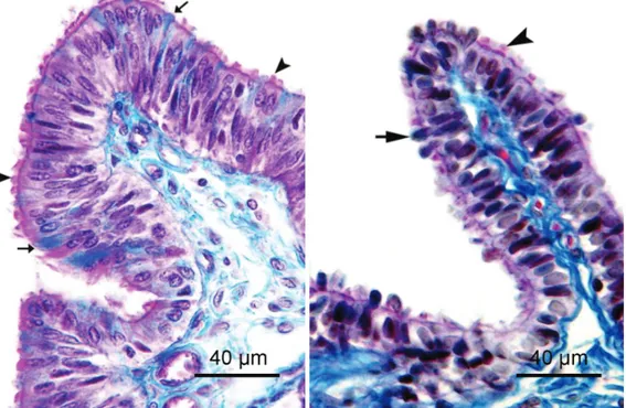 Şekil 1.A. Ampulla epiteli, östral dönem. Silyumlu hücre (ok başı), sekretorik hücre (ok)