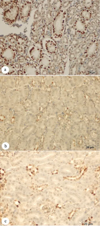 Figure 7: Tunel stain; apoptotic tubulus cells in kidney; a.  Intensive (Group heat stress),  Bar: 20 μm