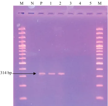 Şekil 1- PZR Ürünlerinin Agaroz Jeldeki Görüntüsü. M- 100 bp  marker. N, negatif,  S. aureus (ATCC 29213) P-  mecA-pozitif, S