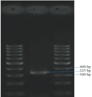 Figure 3.  SCCmec  type V M:  Marker:  100  bp  DNA  ladder,             1: SCCmec type V (325 bp) 