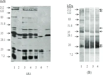 Figure 1. Evaluation of B. bronchiseptica extracts of different  strains by SDS-PAGE (A) and Western Blot (B) analysis