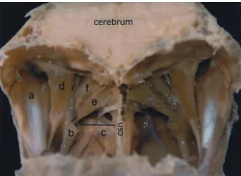 Fig. 4: Lateral view of the masticatory muscles in long-legged  buzzard. 