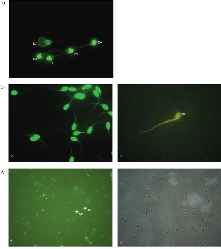 Şekil 1. FITC-PSA, AO ve TUNEL ile boyanan koç spermasının görüntüleri  Satır 1: FITC-PSA ile boyanmış hasar görmüş akrozom (X40) 