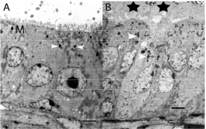 Şekil 9: A) Duktus deferens (kraniyal bölüm) görülmektedir.  M: mitokondriyonlar, ok başı: elektron yoğun granüller, Bar:  0,21µm  B) Duktus deferens (kaudal bölüm) görülmektedir