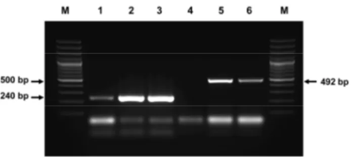 Fig 2. Electrophoresis of PCR product using by PCV and PCV  2 Detection Kit 