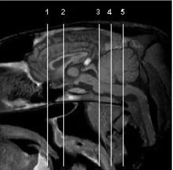 Figure 1. Midsagittal T1-weighted magnetic resonance image  of donkey head showing the levels of transverse planes