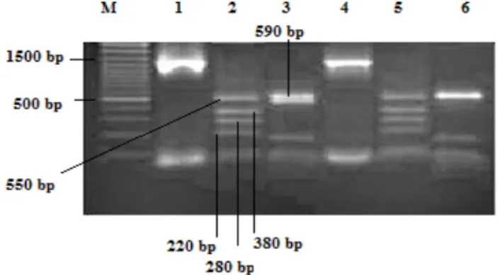 Şekil 1. RFLP bant paternleri. M: Marker (100 bp DNA Ladder  Plus) 1: E. faecium 16S rDNA 2: E.faecium-Hha1  kesimi 3: 