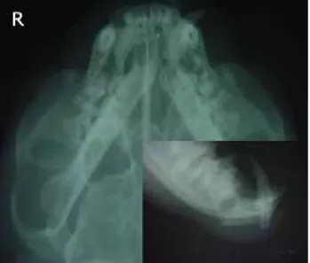 Figure 1- Preoperative radiographs of case no. 1.  Şekil 1- Olgu no. 1’in preoperatif radyografileri