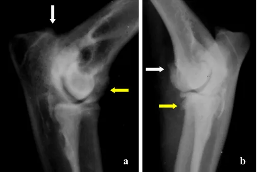 Şekil 1.  a. İlerlemiş osteoartrite bağlı olarak incisura trochlearis’te eklem sınırlarının kaybolması (beyaz ok) ve condylus humeri’de  peritrochlear osteofitozis ile radio-humeral uyumsuzluk(sarı ok), (olgu no: 3)