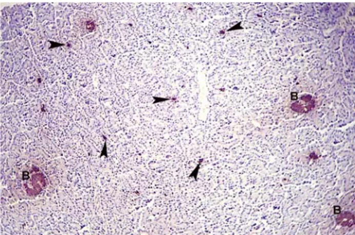 Figure 6. Insulin immunpositive beta cells in exocrine  parenchyma (arrow heads), beta islets (B)