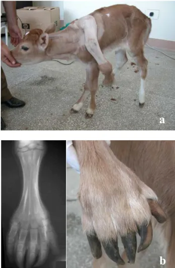 Figure 1. (a) Preoperative appearance of case no:1, (b) clinical  and radiographical appearance of polymetacarpie and  polydactyly