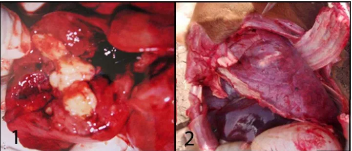 Figure 1. Lung, case number 7; nodule; yellowish-white in colour and fluctuant in consistency