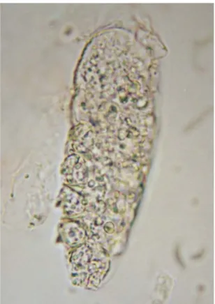 Figure 2B: Demodex criceti  Şekil 2B: Demodex criceti  