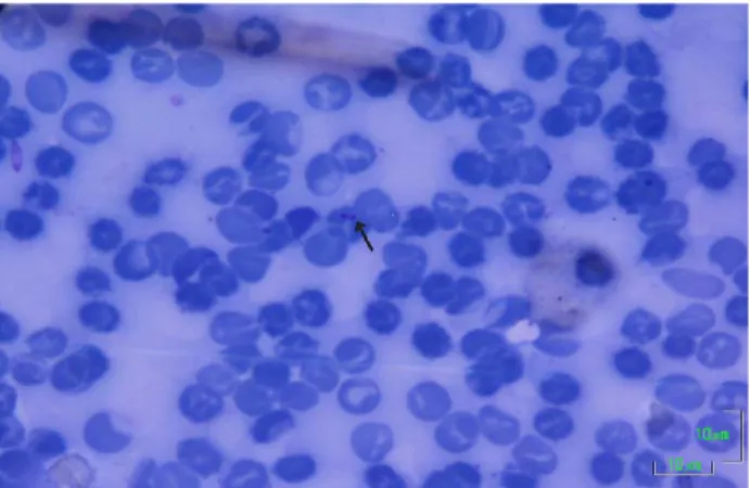 Figure 1. Trypomastigot form of T.lewisi in thin blood smears.  Bar: 10 µm 