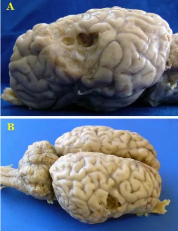 Figure 1.  Necrosis and cavitations on the cerebral hemispheres,  A-) Case 1-lateral view B-) Case 2-dorsolateral view 
