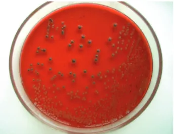 Şekil 1. XLT4 agarda Salmonella kolonilerinin görünümü  Figure 1. The view of Salmonella colonies on the XLT4 agar 