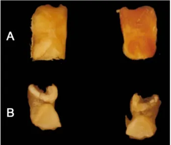 Şekil 1. Patella (cranial’den görünüş). A. Erkek ördek, B. Dişi  ördek. 