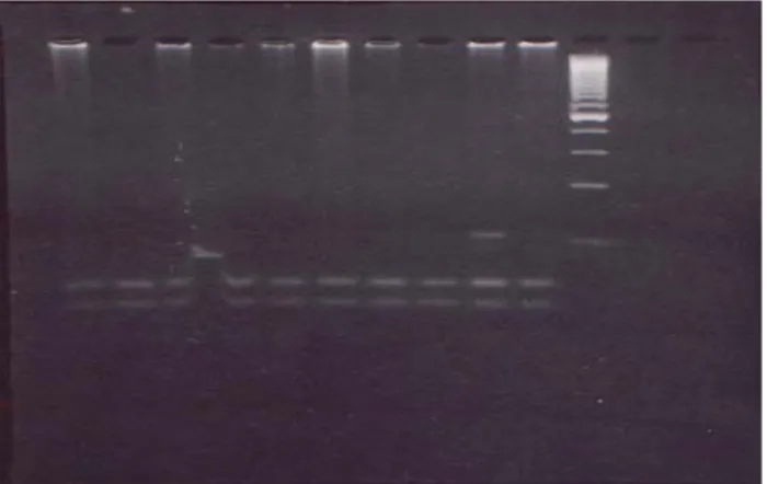 Şekil 1. PCR ürünlerinin Ava I restriksiyon enzimi ile  kesilmesinden elde edilen DNA parçalarının % 4’lük NuSieve  agaroz jel elektroforezi (sırasıyla S30, M29, B7, M13, Hızır,  S44, S15, 495 Edirne, S5, 12M, 100 bp ladder) 