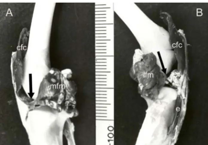 Figure 3. Photograph of the knee joint – medial (A) and lateral  (B) aspects. 