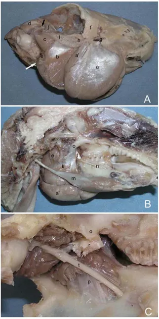 Şekil 3. Tavşanda çiğneme kaslarının lateral’den (A), medial’den  (B,C) görünüşü  