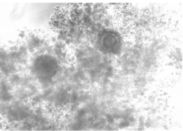 Figure 1. Rabbit oocytes with cumulus cells   Şekil 1. Kumulus hücreli tavşan oositleri 