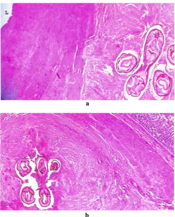 Figure 2. Microscopical appreance in spirocercosis.  