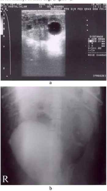 Figure 4. Ventrodorsal view of 20 minutes after (a) intravenous  injection of contrast medium for EU, and longitudinal  sonogram of left kidney (b) in a 9-year-old male Setter